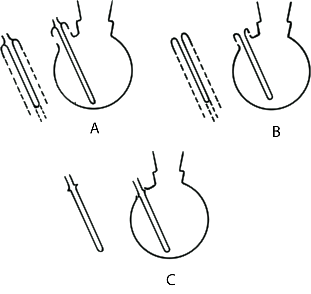 Figura 1. Tres métodos de sellado de pozos termométricos en matraces.